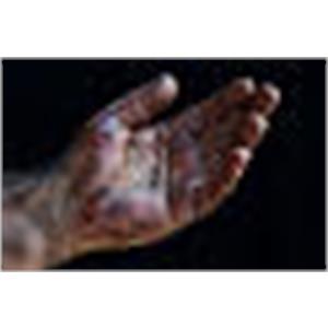 Reiniging en verzorgen van huid